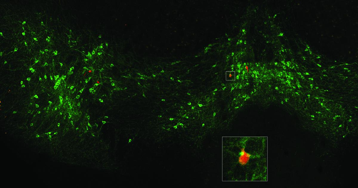 Dopamine signals when a fear can be forgotten