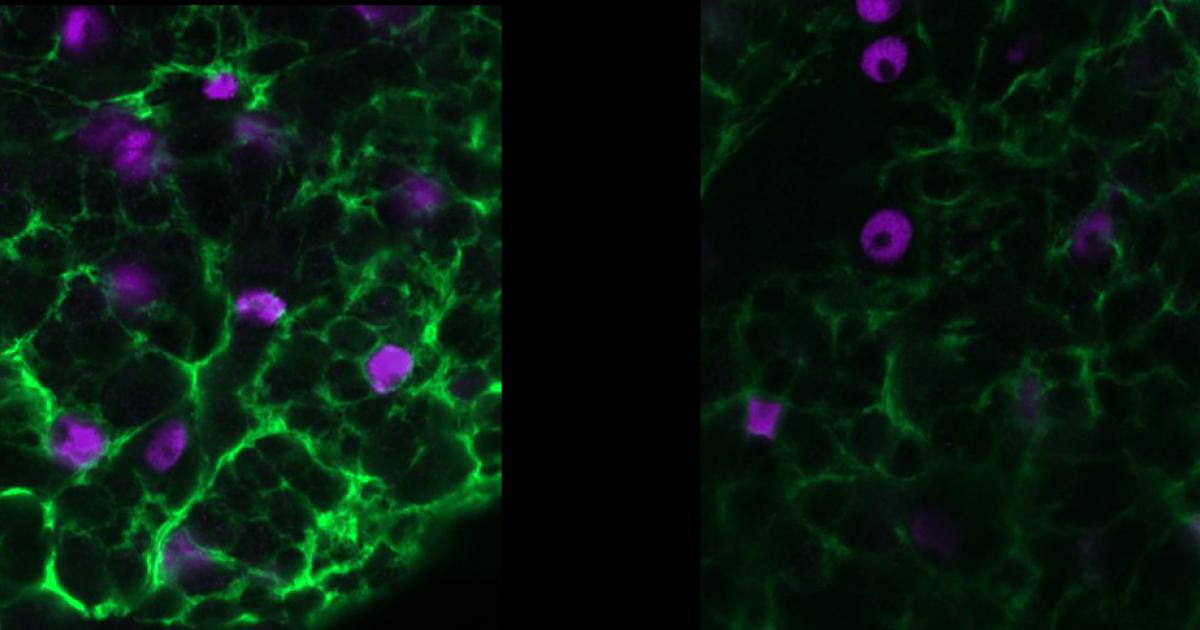 Study reveals how glial cells may play key epilepsy role | Picower