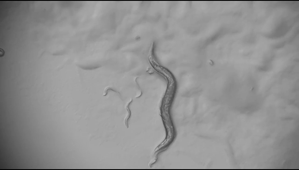 In a grayscale image a wiggly worm is seen in a vertical orientation above a lumpy background of bacteria